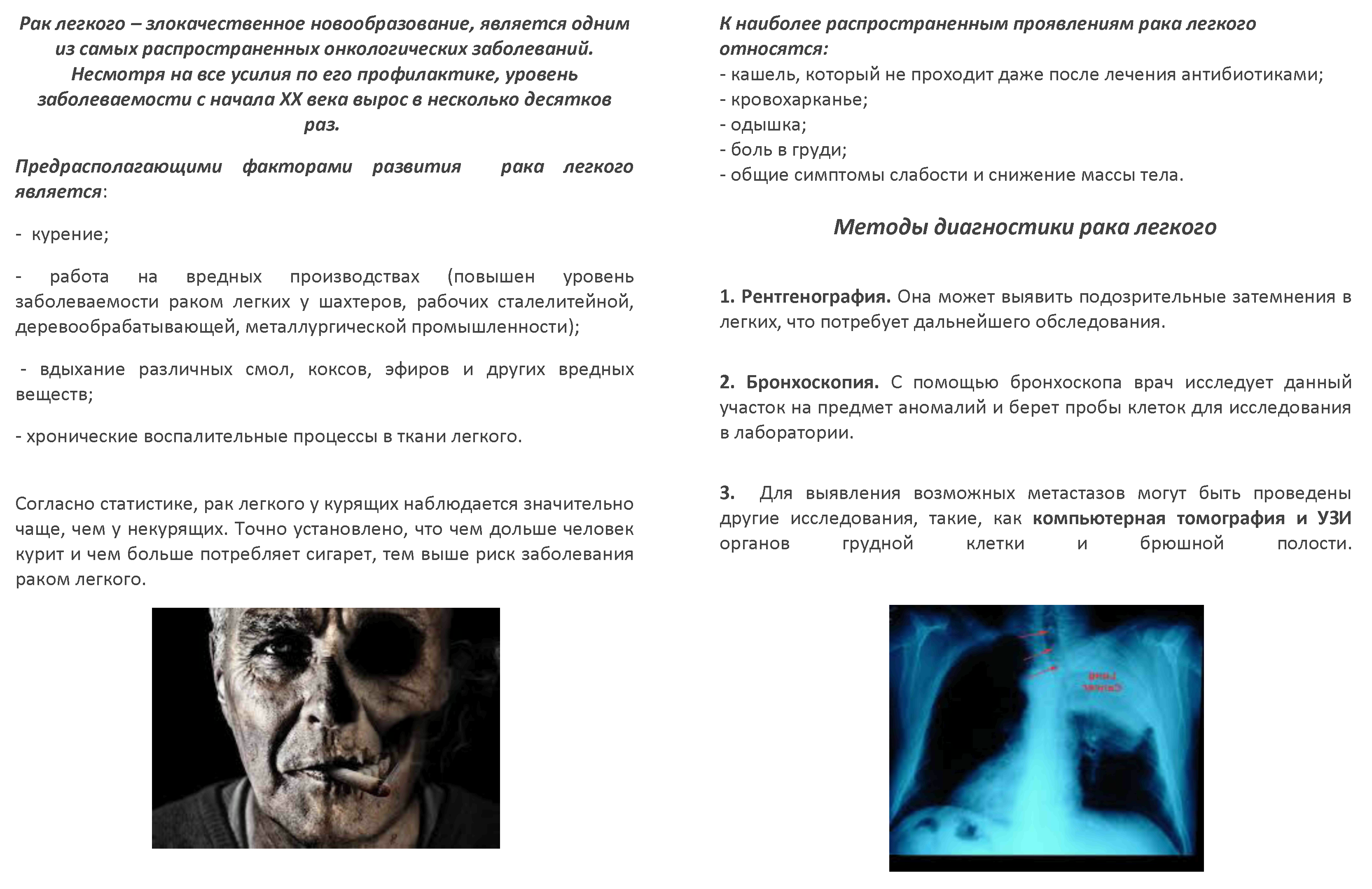 Онкозаболевания | Краевая клиническая больница